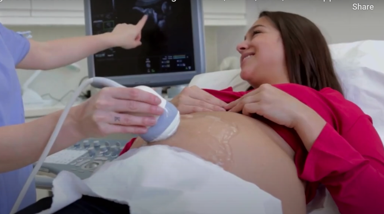 PACSBridge demo video thumbnail showing ultrasound sharing workflow
