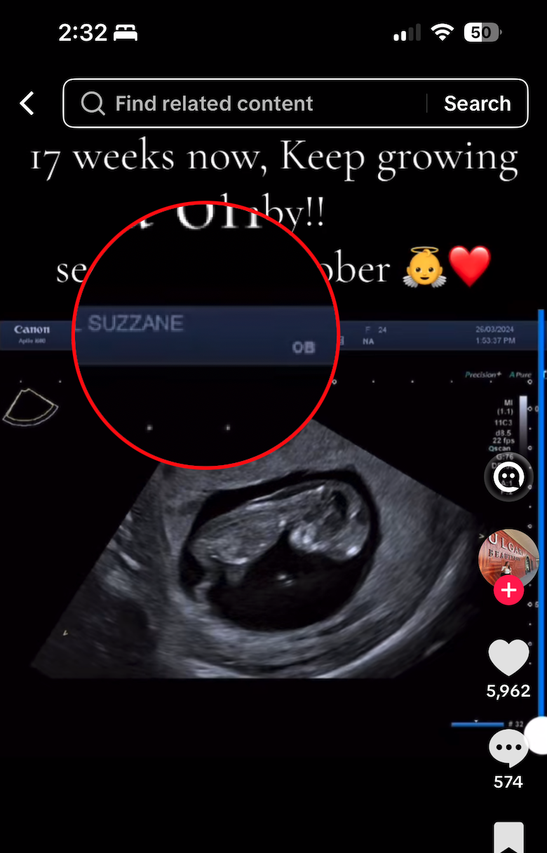 Example of patient portal sharing with personally identifiable information visible on ultrasound images