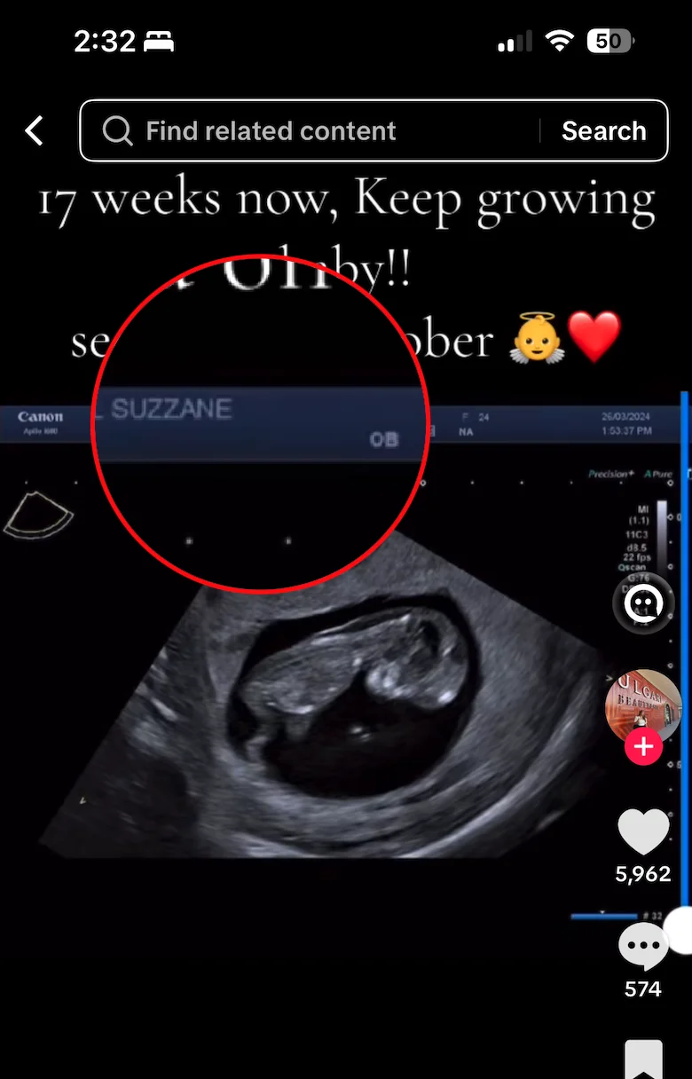 Example of a patient portal ultrasound shared to social media with personally identifiable information still visible